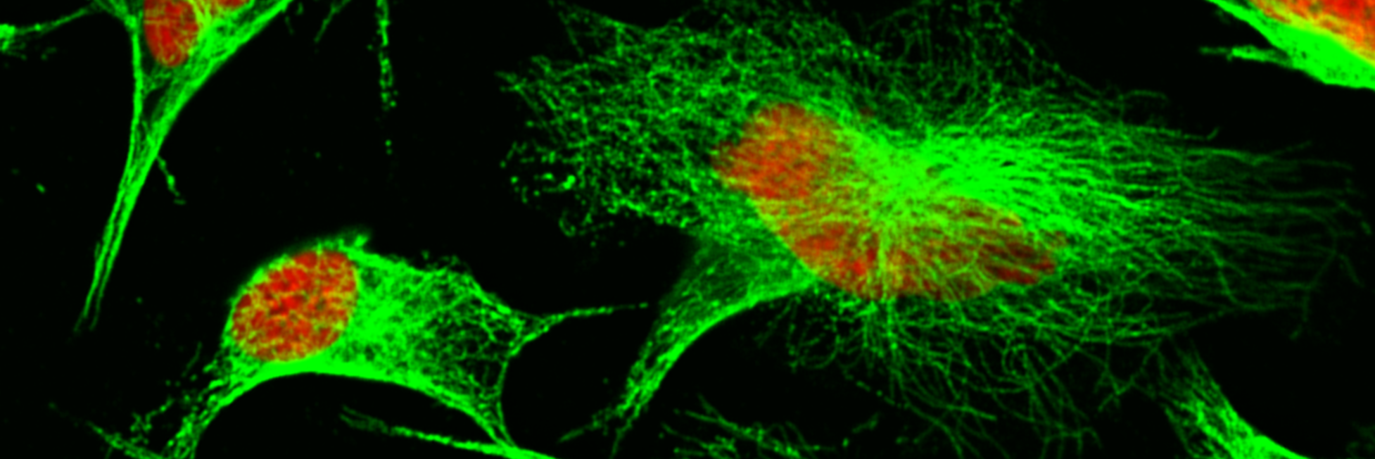 tubulin network in neuroblastoma cells
