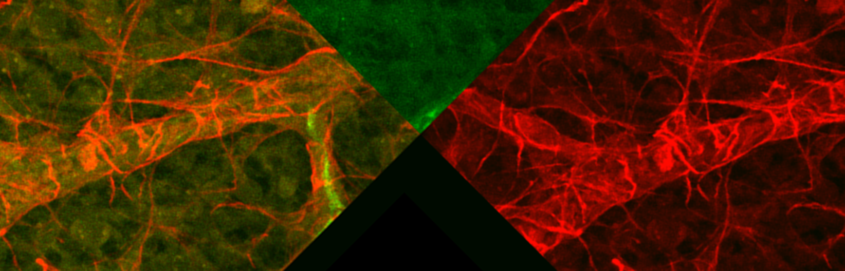 Corneal blood vessels