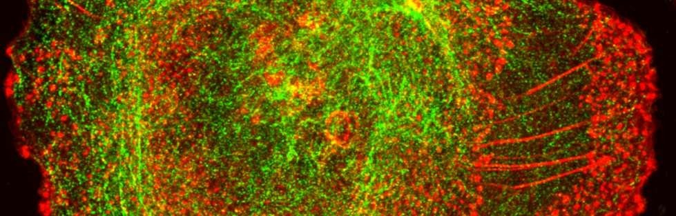 Actin (red) and Tubulin (green) networks in macrophage