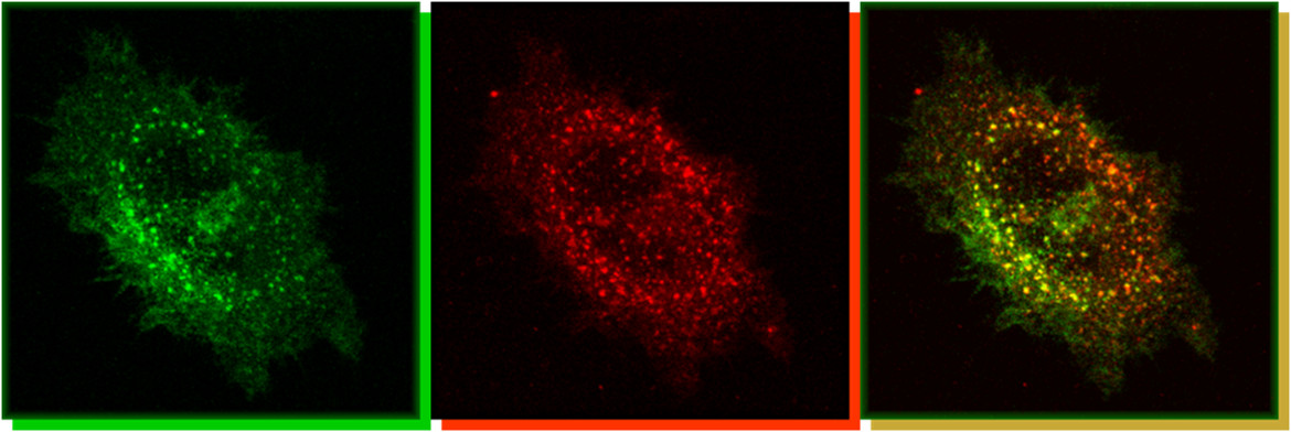 Early and late endosomes in an epithelial cell
