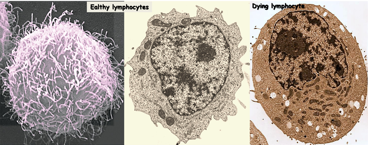 Human B lymphocytes